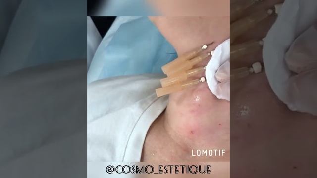 Нити смотреть онлайн