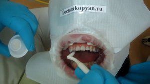 Люминиры установка. Часть 1