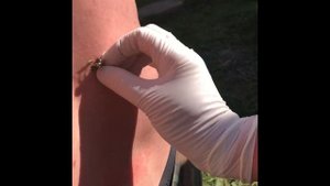 Апитерапия! Лечение пчёлами ! Apitherapy. Bee sting treatment. Народная медицина