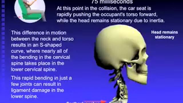 WA Auto Injury Movie смотреть онлайн