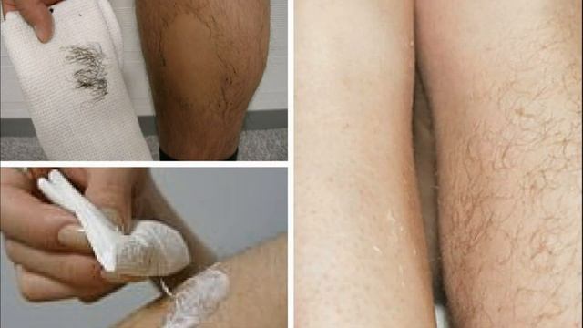 Как избавиться от волос на теле смотреть онлайн