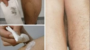 Как избавиться от волос на теле