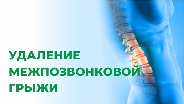 Операция по удалению грыжи диска. Как проходит операция. Что происходит после операции.
