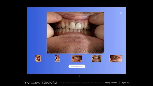 Practice Plan Webinar: Looking towards the future with virtual and digital dentistry. смотреть онлайн