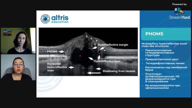 Друзы ДЗН. Клиника, тактика ведения, дифференциальная диагностика смотреть онлайн