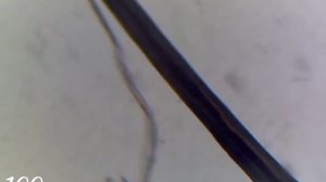 волос человека под микроскопом