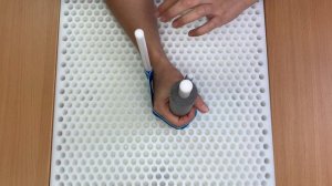 Тугоподвижность суставов кисти I Эрготерапевт О.Вилдфанга