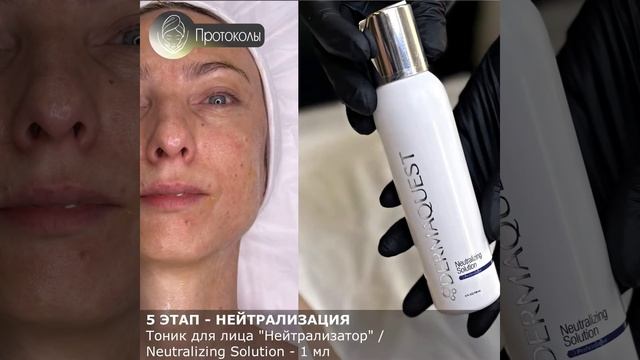 Пилинг "МангоБрайт" от пигментных пятен DermaQuest, США