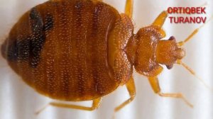 KLAPANI YUQOTISH USULLARI,klopa chaqishi oqibatlari,najimni chaqqan klopa ham bor ichida