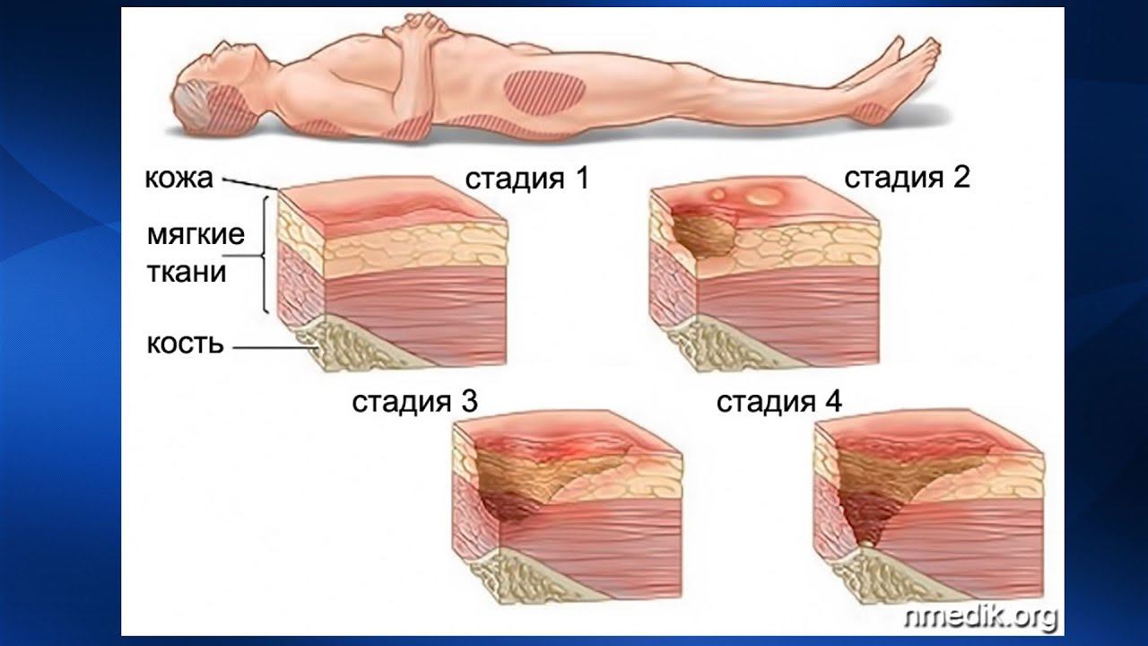 Послойное строение лица. Кожаное полотно. Кожаный материал. Мягкая кожа. Кожа это мягкие ткани.