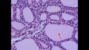 Эндокринная система. гистологические препараты