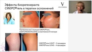 Многозадачный Сферогель. Составляем идеальный протокол