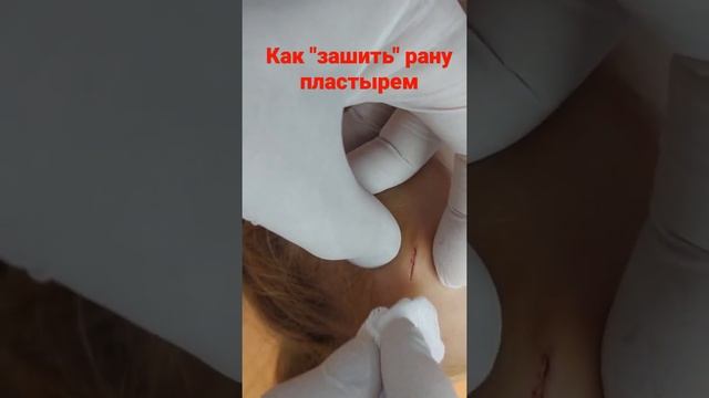 как "зашить" рану пластырем правильно