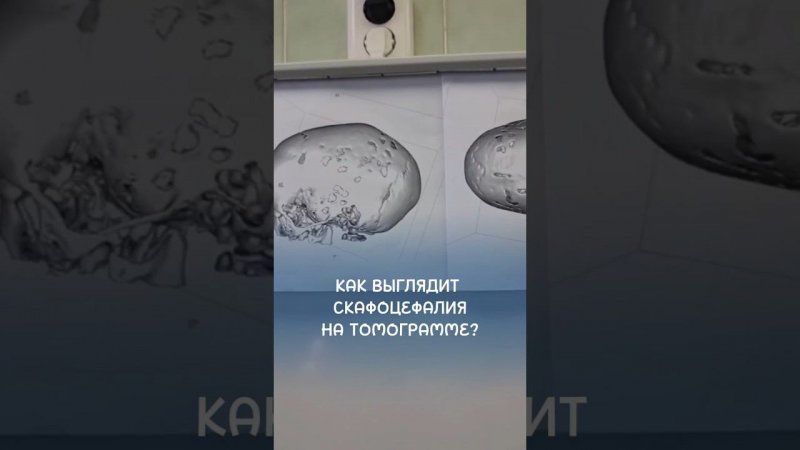 Что может произойти, если упустить время и вовремя не провести операцию?