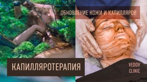 Капилляротерапия в клинике Ведова. Мощная активизация кровообращения и регенерация клеток организма