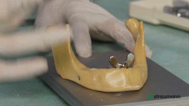 Установка имплантата: Straumann® Bone Level смотреть онлайн