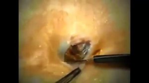 камедон(старая черная точка)