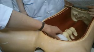 Ведение родов при ягодичном предлежани. Пособие по Цовьянову