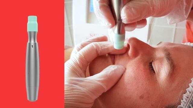 Poly Abrasion / полибразия/аппаратная микрошлифовка кожи Dermia Solution