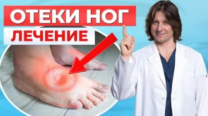 Что делать если отекают ноги? 5 причин и способы лечения отека ног