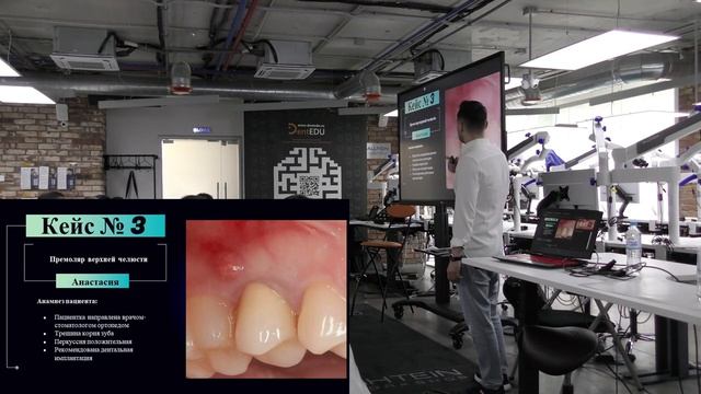 Лекция "Одномоментная имплантация без осложнений" смотреть онлайн