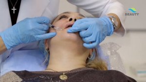 Коррекция средней трети лица, коррекция периоральной зоны