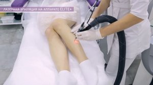 ЛАЗЕРНАЯ ЭПИЛЯЦИЯ НА АППАРАТЕ ELITE+