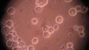 Жинсий азога сугал чикиши сабаби