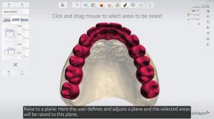 3Shape Splint Studio - The general workflow for Splint Studio