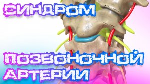 "СИНДРОМ ПОЗВОНОЧНОЙ АРТЕРИИ: НЕВЕРОЯТНЫЕ ФАКТЫ и ЭФФЕКТИВНЫЕ МЕТОДЫ ЛЕЧЕНИЯ!"