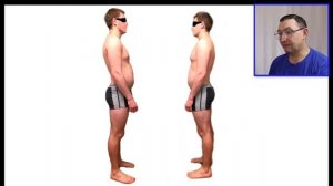 Грыжа межпозвонкового диска.Видим причины по осанке.Остеопатия.Кинезиология.