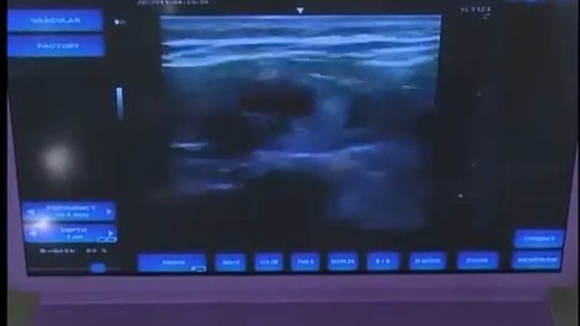 Появляются синяки, что делать смотреть онлайн