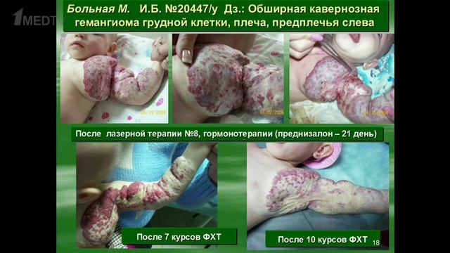 Девять устных презентаций лучших постерных докладов