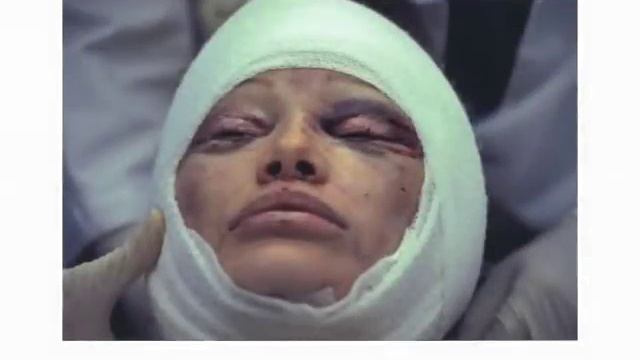 A Facelift Diary смотреть онлайн