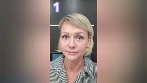 Коктейль принцесса Монако Биоревитализация+Ботокс Мгновенный лифтинг эффект или нет?!!
