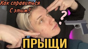 ПРЫЩИ ПО ВСЕМУ ЛИЦУ! КАК ИЗБАВИЛСЯ?