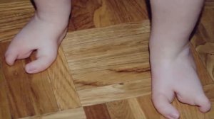 САМЫЕ СТРАШНЫЕ ГЕНЕТИЧЕСКИЕ МУТАЦИИ