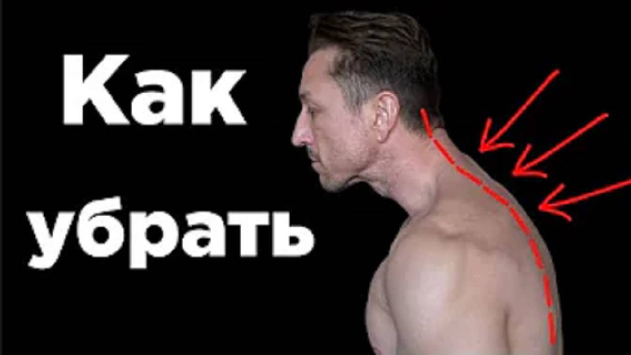 Как убрать компьютерную шею. Компьютерная шея. Компьютерная шея как исправить. Тренажеры ролики убрать холку.