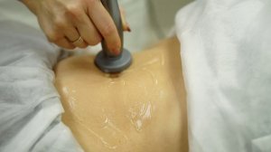 RF-лифтинг тела.