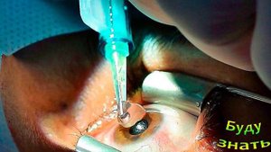 Мультифокальные линзы и монофокальные линзы: что лучше для вашего зрения?