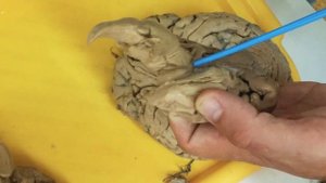 Промежуточный мозг - diencephalon; разбор препарата
