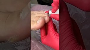 Педикюр за 45 минут колпачками