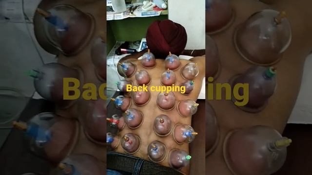 cupping therapy for muscle growth, decrease stiffness and pain