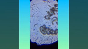 Водоросль спирогира под микроскопом