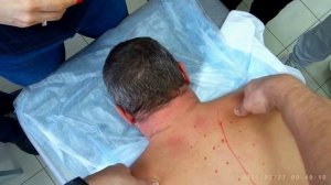 Глубоко рефлекторный массаж при бронхите, пневмонии, заложенности носа, мигрени, головных болей