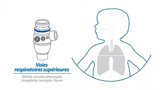 Omron A3 Complete Nébuliseur - Nébuliseur 3 positions смотреть онлайн