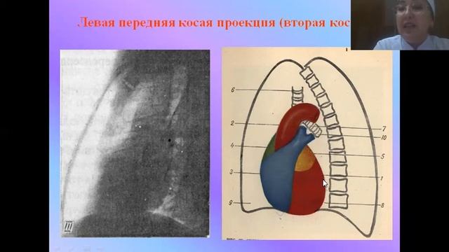 Лучевая диагностика заболеваний сердечно   сосудистой системы