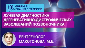 Рентгенолог Макогонова М.Е.: Лучевая диагностика дегенеративно-дистрофич-их заболеваний позвоночника