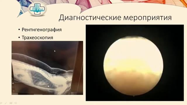 Торакальная хирургия Основные и часто встречаемые патологии смотреть онлайн