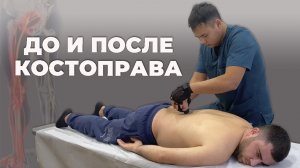 Болит поясница, отдает в ноги до пяток|Костоправ Асыр Хан